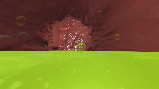 A 3D rendering shows bile in the stomach.